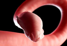 Avanzan investigaciones interinstitucionales contra la cisticercosis