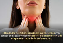 Consumo de tabaco, causa principal de desarrollo de cáncer de cabeza y cuello