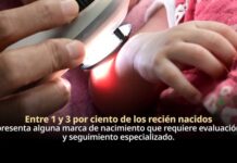Marcas de nacimiento requieren valoración médica oportuna para identificar riesgos y brindar tratamiento adecuado